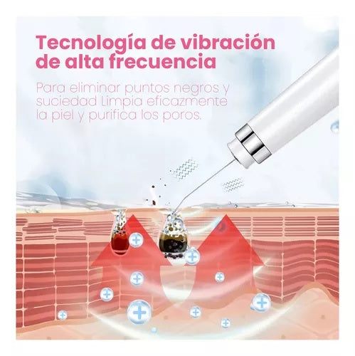 Combo Espatula Extractora Espinillas Limpieza Ultrasonica + 2 Bandas Diadema Cabello