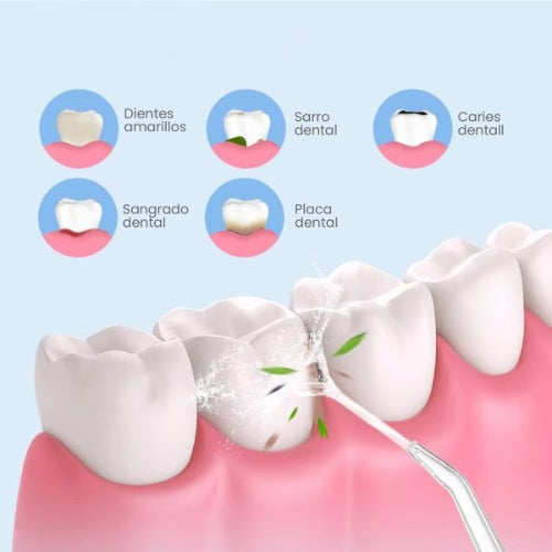 Irrigador Dental De Limpieza Oral Premium